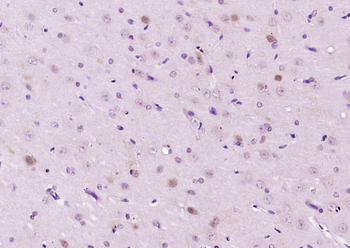 FMN1 Rabbit Polyclonal Antibody