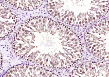 FMN1 Rabbit Polyclonal Antibody