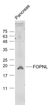 FOPNL Rabbit Polyclonal Antibody