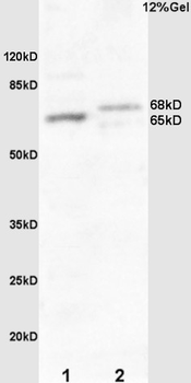 Frizzled 10/CD350 Rabbit Polyclonal Antibody