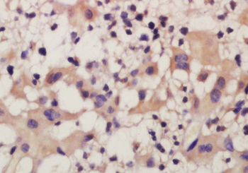 Frizzled 10/CD350 Rabbit Polyclonal Antibody