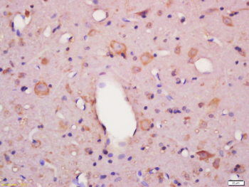 Frizzled 6 Rabbit Polyclonal Antibody