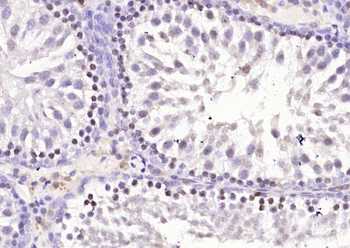 FYTTD1 Rabbit Polyclonal Antibody