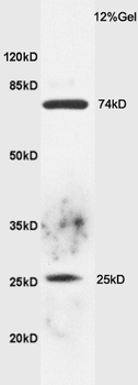FZD3 Rabbit Polyclonal Antibody
