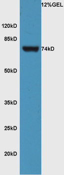 FZD3 Rabbit Polyclonal Antibody