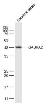 GABRA2 Rabbit Polyclonal Antibody