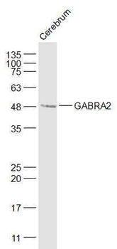 GABRA2 Rabbit Polyclonal Antibody