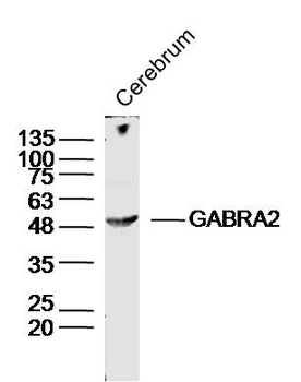 GABRA2 Rabbit Polyclonal Antibody