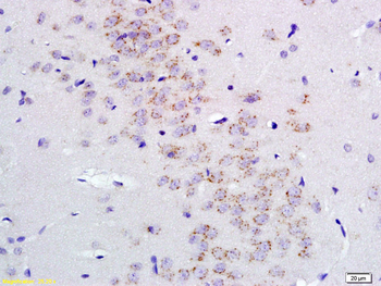 GABRA2 Rabbit Polyclonal Antibody