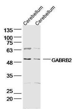 GABRB2 Rabbit Polyclonal Antibody