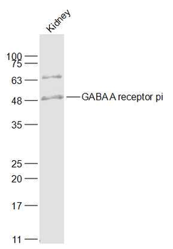 GABA A receptor pi Rabbit Polyclonal Antibody