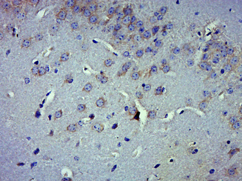 GAD65 + GAD67 Rabbit Polyclonal Antibody