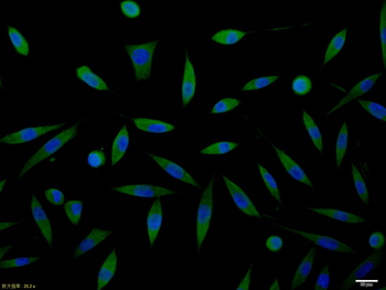 GAD65 + GAD67 Rabbit Polyclonal Antibody