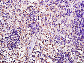 Galectin 3 Rabbit Polyclonal Antibody