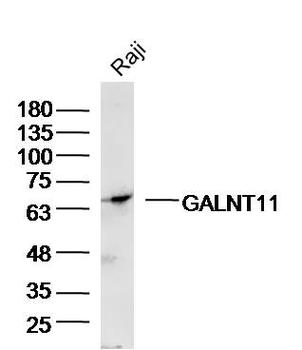 GALNT11 Rabbit Polyclonal Antibody