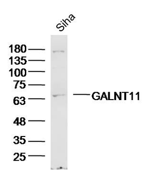 GALNT11 Rabbit Polyclonal Antibody