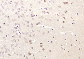 GARNL1 Rabbit Polyclonal Antibody