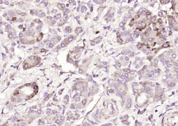GCNT1 Rabbit Polyclonal Antibody