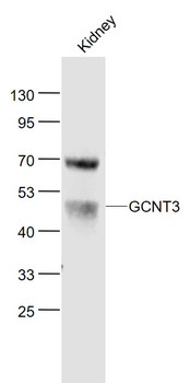 GCNT3 Rabbit Polyclonal Antibody
