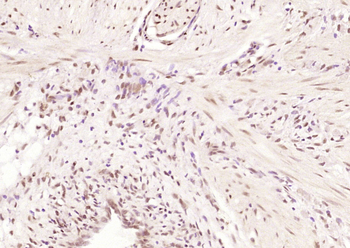 GEM Rabbit Polyclonal Antibody