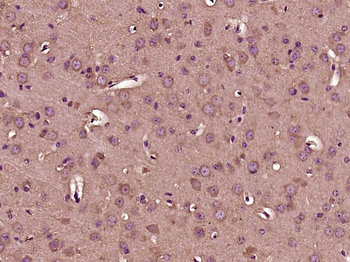 Gemin 1 Rabbit Polyclonal Antibody