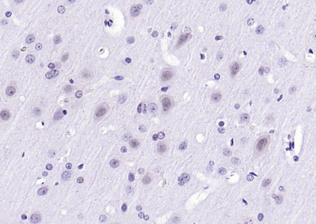 Gemin 2 Rabbit Polyclonal Antibody