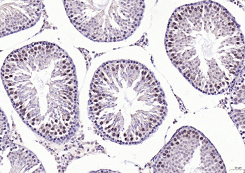 Gemin 2 Rabbit Polyclonal Antibody