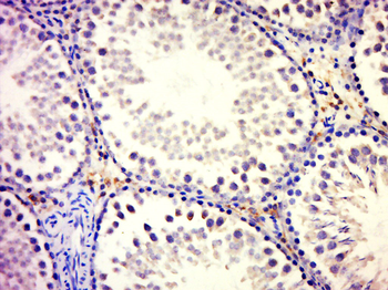 GFM2 Rabbit Polyclonal Antibody