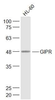 GIPR Rabbit Polyclonal Antibody