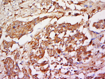 Phospho-Girdin (Tyr1765) Rabbit Polyclonal Antibody