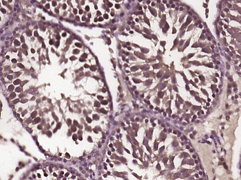 Beta galactosidase Rabbit Polyclonal Antibody