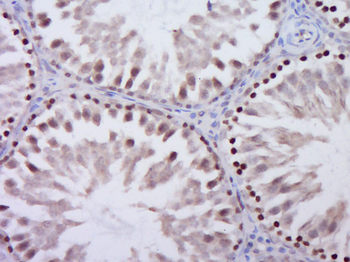 Gli2 Rabbit Polyclonal Antibody