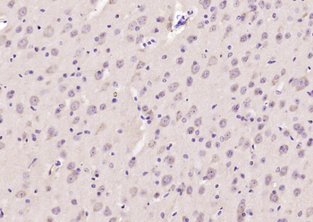 GLIS2 Rabbit Polyclonal Antibody