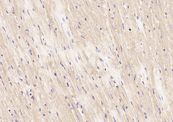 GLIS2 Rabbit Polyclonal Antibody
