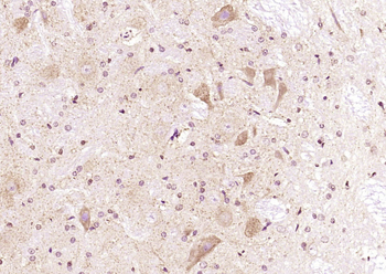 QARS/Glutamyl Prolyl tRNA synthetase/ProRS Rabbit Polyclonal Antibody