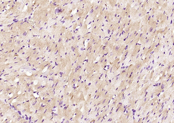 QARS/Glutamyl Prolyl tRNA synthetase/ProRS Rabbit Polyclonal Antibody