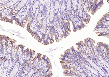 Pan Cytokeratin Mouse Monoclonal Antibody