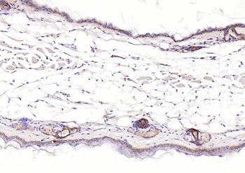 Pan Cytokeratin Mouse Monoclonal Antibody