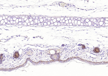 Pan Cytokeratin Mouse Monoclonal Antibody