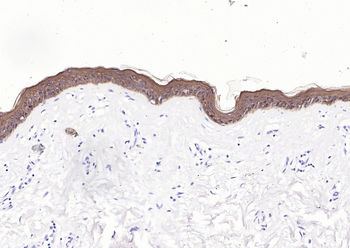 Pan Cytokeratin Mouse Monoclonal Antibody