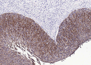 Pan Cytokeratin Mouse Monoclonal Antibody