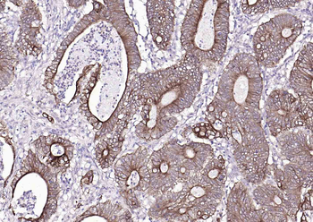 Pan Cytokeratin Mouse Monoclonal Antibody