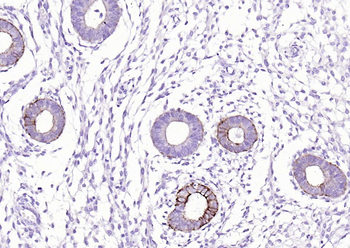 Pan Cytokeratin Mouse Monoclonal Antibody