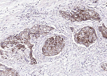 Pan Cytokeratin Mouse Monoclonal Antibody