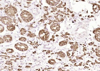 Pan Cytokeratin Mouse Monoclonal Antibody