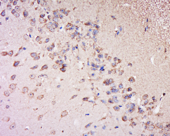 GNL2 Rabbit Polyclonal Antibody