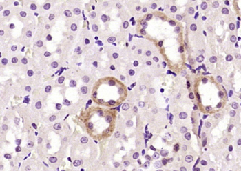 GOT1L1 Rabbit Polyclonal Antibody