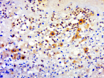 GPATCH3 Rabbit Polyclonal Antibody
