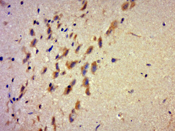 GPATCH3 Rabbit Polyclonal Antibody