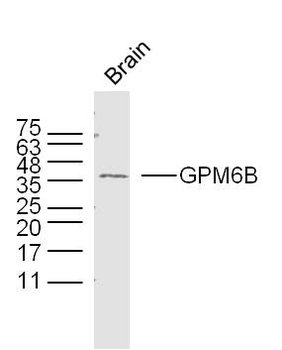 GPM6B Rabbit Polyclonal Antibody